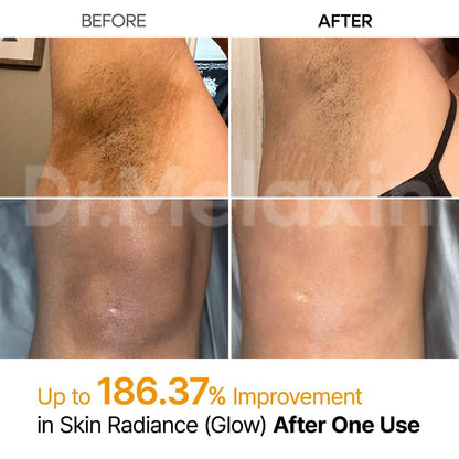 Skin Tone Rebalancing Spray for Darkened Areas