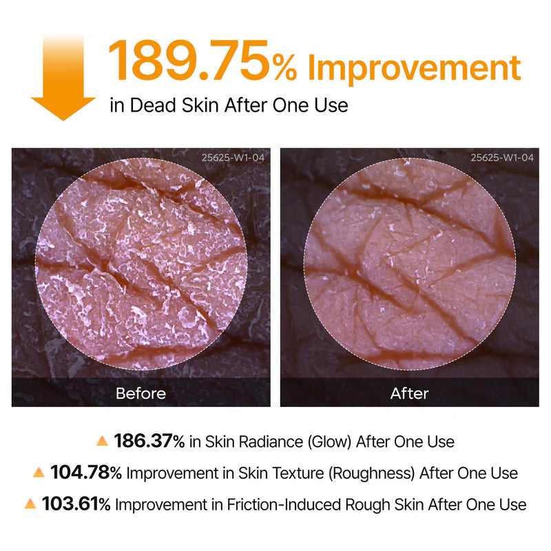 Skin Tone Rebalancing Spray for Darkened Areas